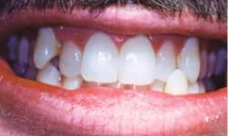 Dentist Tinton Falls