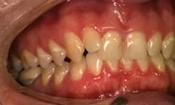 Tinton Falls Dentist