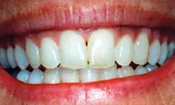 Dentist in Tinton Falls NJ
