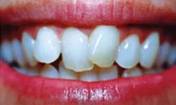 Dentist in Tinton Falls