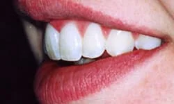 Dentist in Tinton Falls NJ