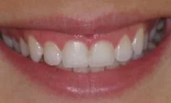Dentist Near Me