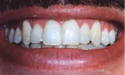 Dentist Tinton Falls NJ