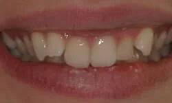 Dentist in Tinton Falls NJ