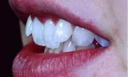 Dentist in Tinton Falls