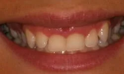 Tinton Falls NJ Dentist