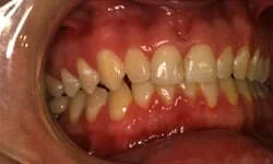 Tinton Falls NJ Dentist