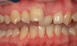 Dentist Near Me