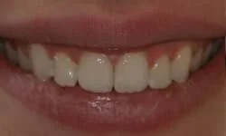 Tinton Falls Dentist